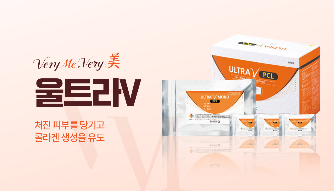 울트라V