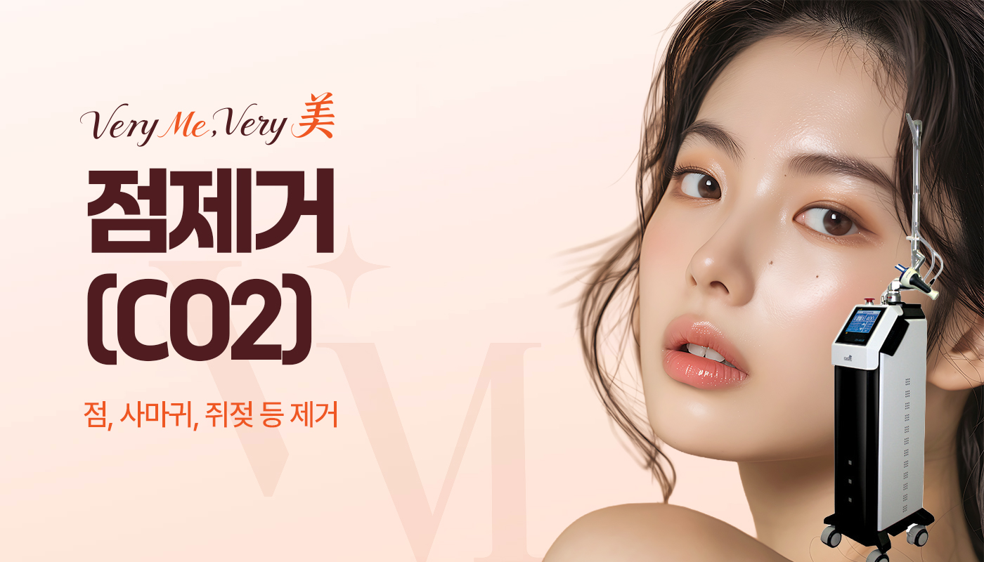 점제거(CO2)